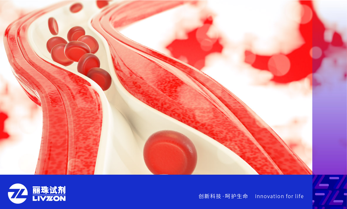 麗科普丨抗磷脂抗體陽性能診斷為「 抗磷脂綜合征 」嗎？